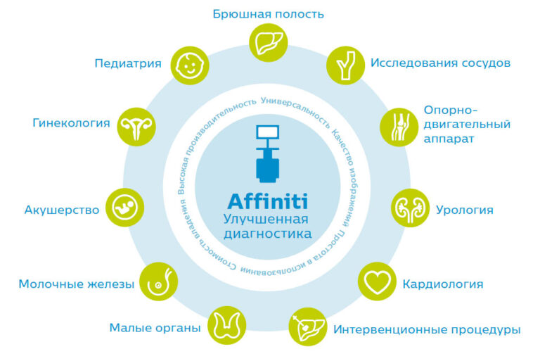 Аппарат УЗИ Philips Affiniti 70 — изображение 4