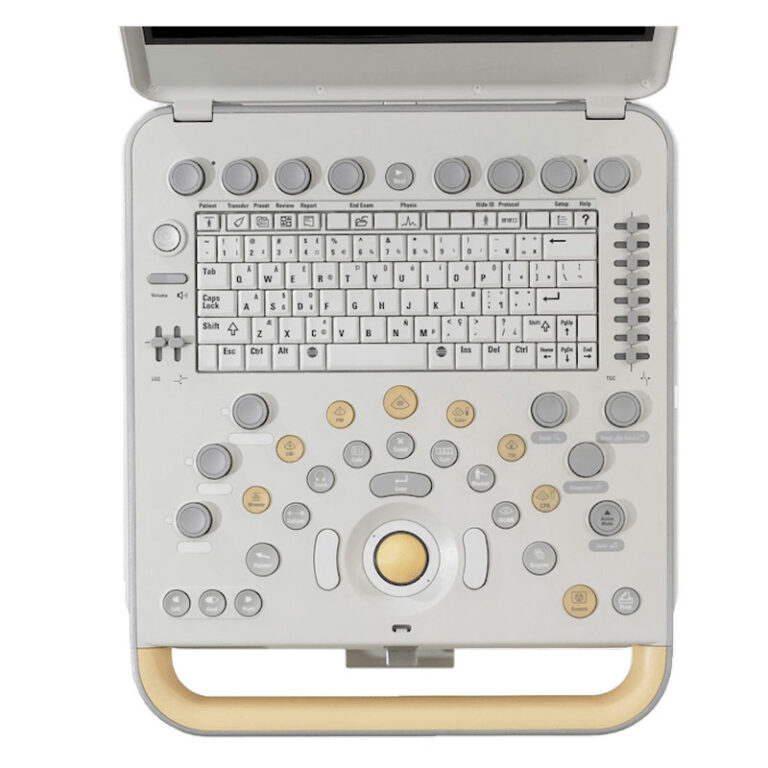 УЗИ Philips CX50