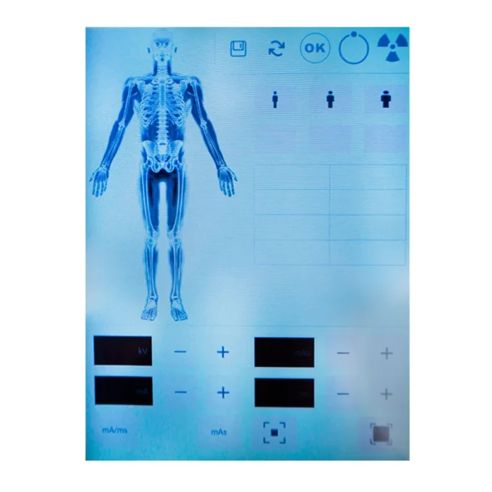 DS.Xray 10010t