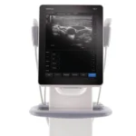 Аппарат Mindray TE7